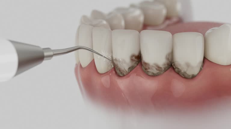 Trusted Tooth Extraction service in Ray City, GA - Dentist Open Now